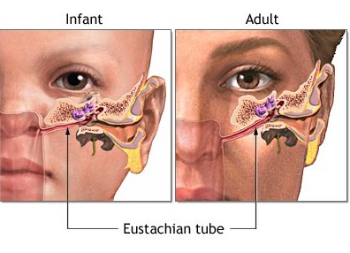 eustachian tube blockage